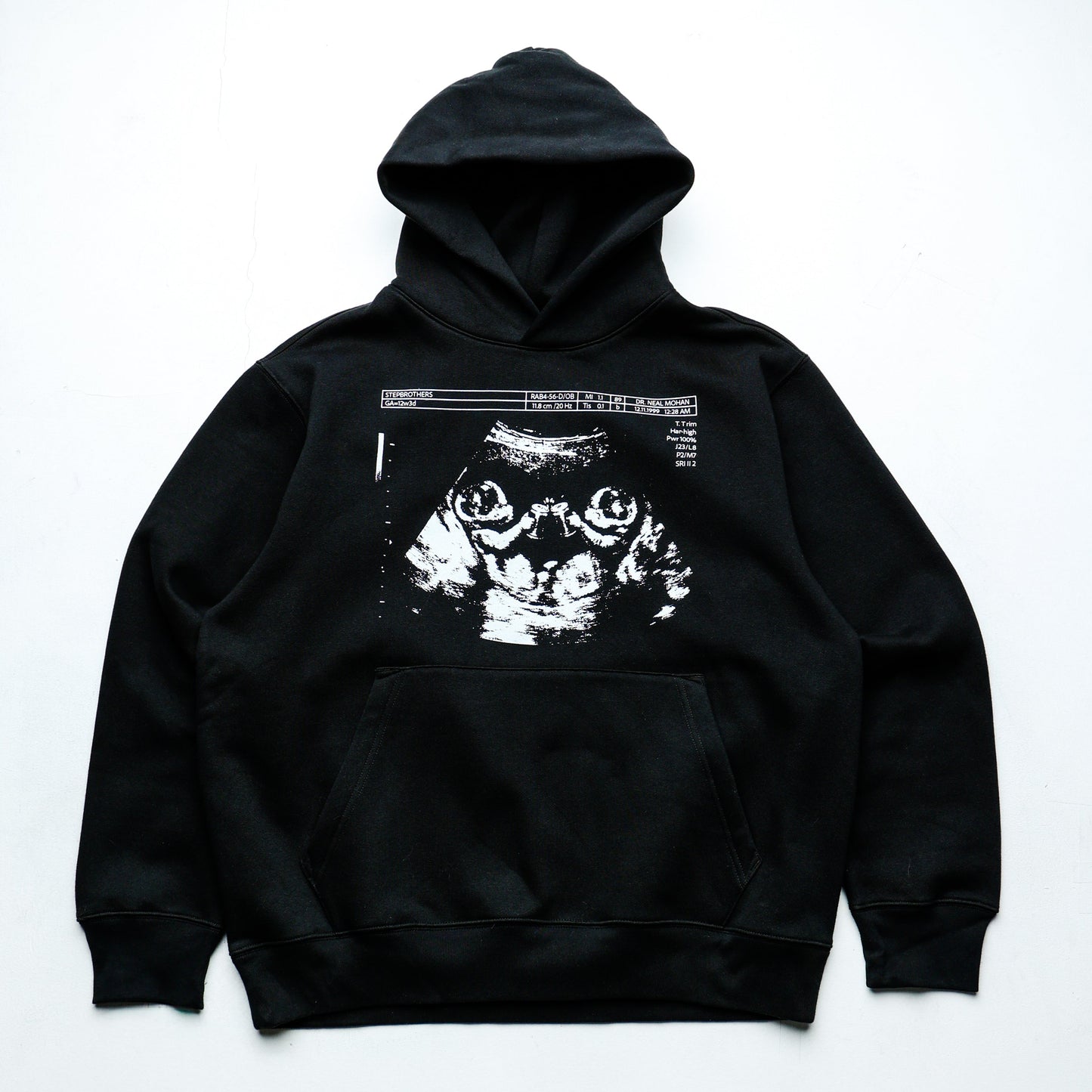 Congrats Ur Having Bigbacks! (hoodie)