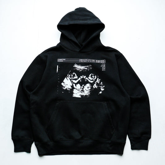 Congrats Ur Having Bigbacks! (hoodie)